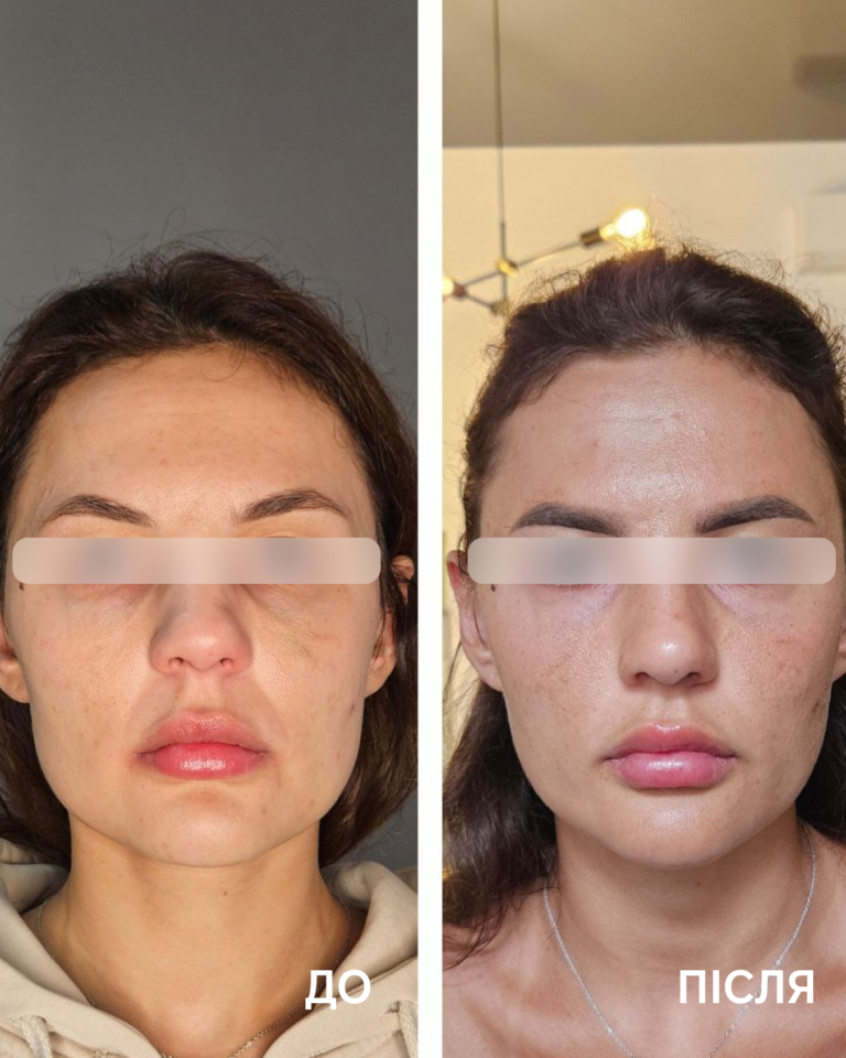 aptos visage excellence